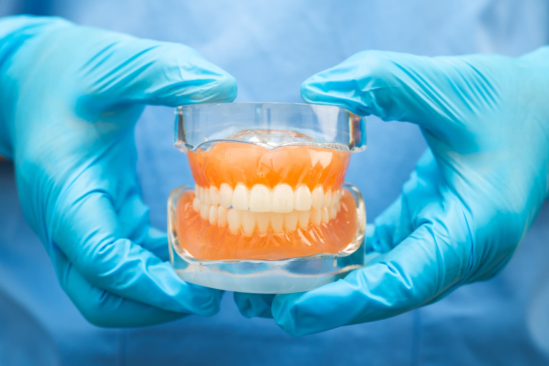 Dentist holding a denture model used to explain how snap-in implant dentures work