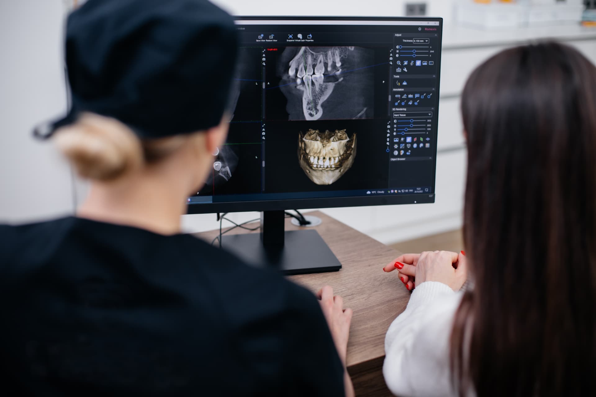 Dentist and patient reviewing a 3D dental CT scan of the jaw on a monitor during an implant evaluation